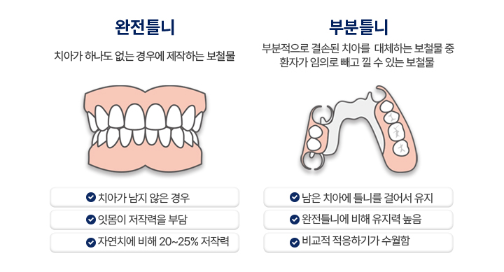 완전틀니