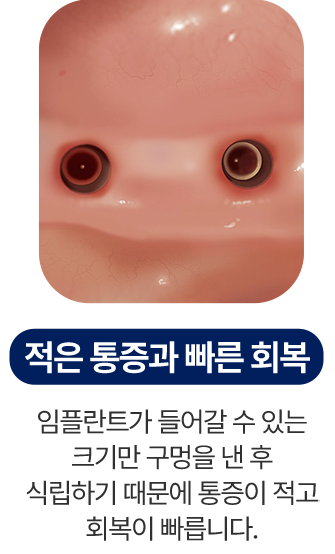 적은 통증과 빠른회복